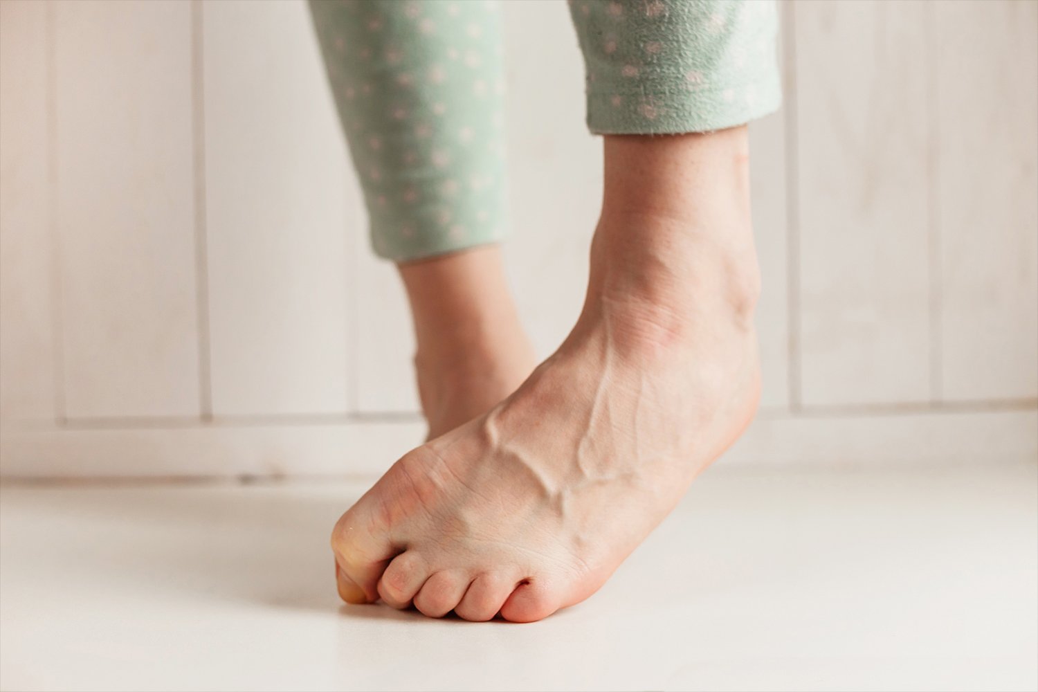 ciorapi de la venele venelor pe picioare instalație pentru tratamentul varicozei