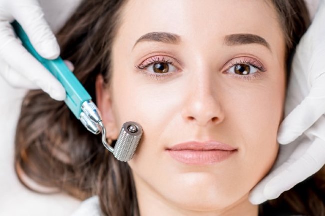 Microneedling